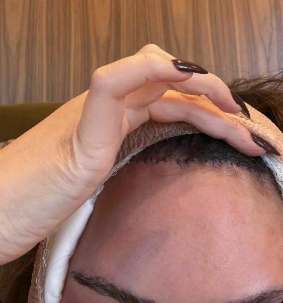 Крисси Тейген перепугала поклонников забинтованной головой — что случилось
Крисси Тейген перепугала поклонников забинтованной головой — что случилось