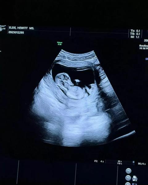 Пит Дэвидсон готовится стать отцом – его девушка ждет ребенка
Пит Дэвидсон готовится стать отцом – его девушка ждет ребенка