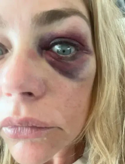 "Душил меня и угрожал убить". Дениз Ричардс обвинила мужа в домашнем насилии "Душил меня и угрожал убить". Дениз Ричардс обвинила мужа в домашнем насилии