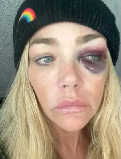 "Душил меня и угрожал убить". Дениз Ричардс обвинила мужа в домашнем насилии "Душил меня и угрожал убить". Дениз Ричардс обвинила мужа в домашнем насилии