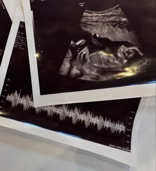 Дебби Райан ждёт первого ребёнка от барабанщика Twenty One Pilots Джоша Дана Дебби Райан ждёт первого ребёнка от барабанщика Twenty One Pilots Джоша Дана