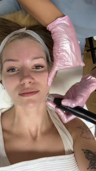 Сестра Кейт Мосс удалила татуировку на лице
Сестра Кейт Мосс удалила татуировку на лице