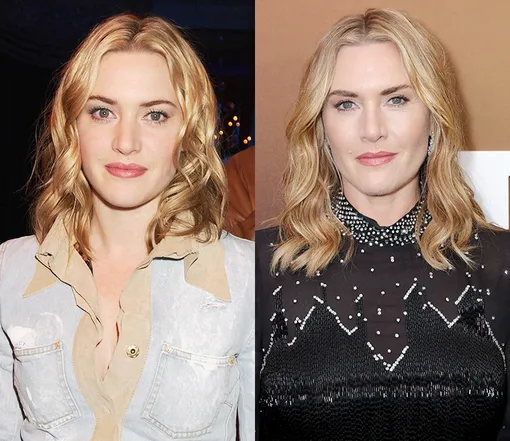 Съели молодильных яблок: звезды, которые почти не постарели за 20 лет