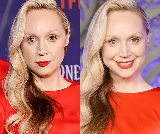 Два разных человека! Как улыбка меняет лицо знаменитостей Два разных человека! Как улыбка меняет лицо знаменитостей