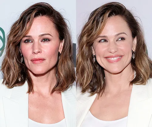 Два разных человека! Как улыбка меняет лицо знаменитостей Два разных человека! Как улыбка меняет лицо знаменитостей