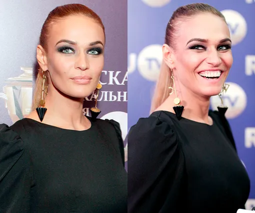 Два разных человека! Как улыбка меняет лицо знаменитостей Два разных человека! Как улыбка меняет лицо знаменитостей