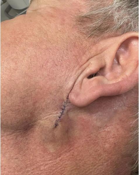 Гордон Рамзи перенес операцию по удалению раковой опухоли
Гордон Рамзи перенес операцию по удалению раковой опухоли