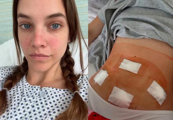 "Бессонные ночи на полу в ванной". Барбара Палвин перенесла операцию из-за гинекологического заболевания "Бессонные ночи на полу в ванной". Барбара Палвин перенесла операцию из-за гинекологического заболевания