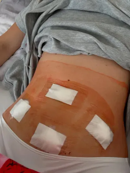 "Бессонные ночи на полу в ванной". Барбара Палвин перенесла операцию из-за гинекологического заболевания "Бессонные ночи на полу в ванной". Барбара Палвин перенесла операцию из-за гинекологического заболевания