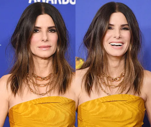 Два разных человека! Как улыбка меняет лицо знаменитостей Два разных человека! Как улыбка меняет лицо знаменитостей