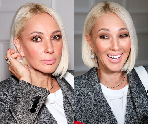 Два разных человека! Как улыбка меняет лицо знаменитостей Два разных человека! Как улыбка меняет лицо знаменитостей