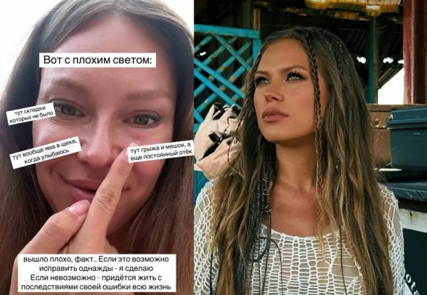 "Хотела стать красивее и моложе. Не вышло". Рита Дакота рассказала о неудачной пластике глаз "Хотела стать красивее и моложе. Не вышло". Рита Дакота рассказала о неудачной пластике глаз