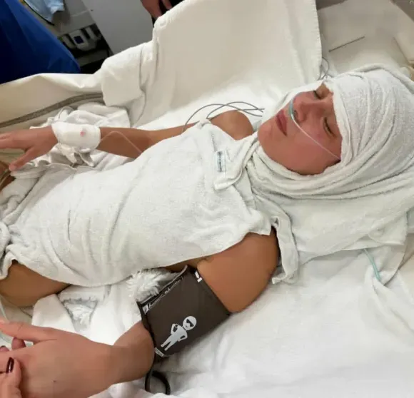 В сети подозревают, что Белла Хадид страдает не от болезни Лайма, а от последствий анорексии